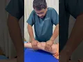 Fixed Flexion deformity FFD Correction of FFD Extension Maintain