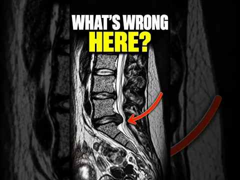 Beyond Pain Relief: Your MRI Is Only Part of the Story