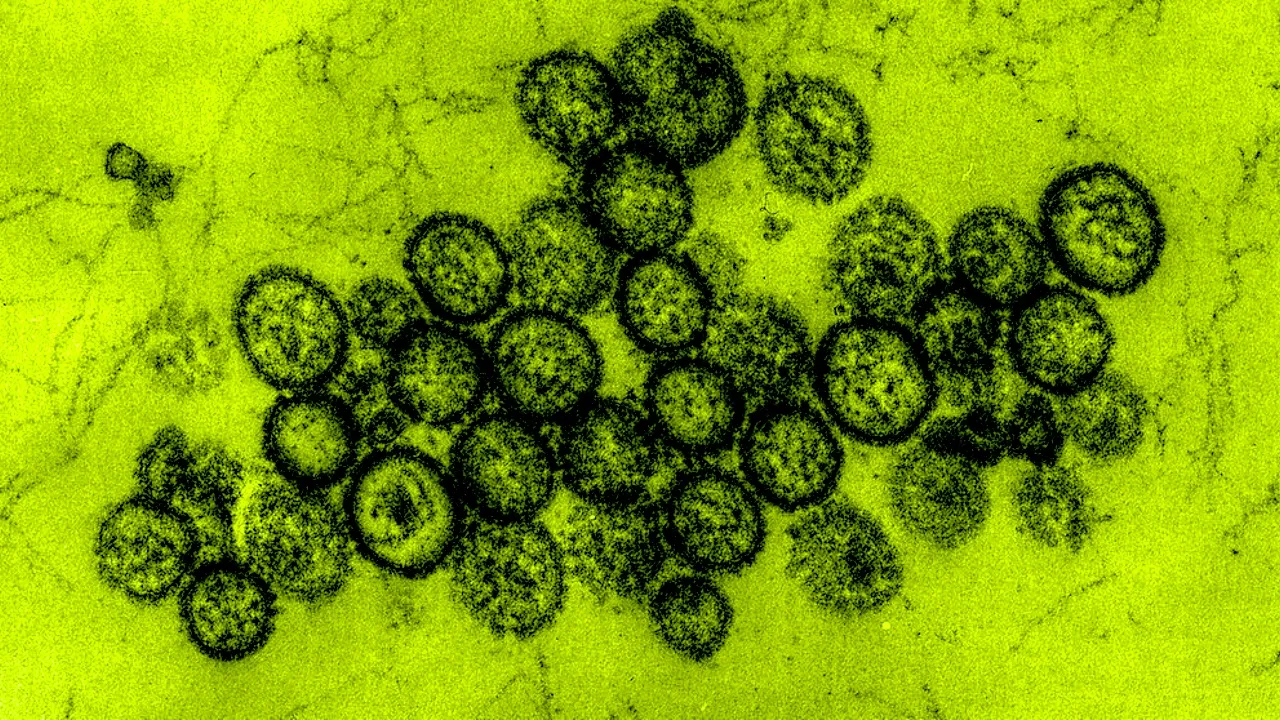 Hantavirus
