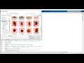 Segmentation and Lesion Periphery Analysis For Characterization of Skin Lesions using Matlab