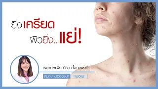 ความเครียดส่งผลต่อผิวหนังอย่างไรบ้าง