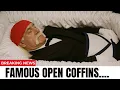 17 Celebrity Open-Casket Funerals That Surprised the World