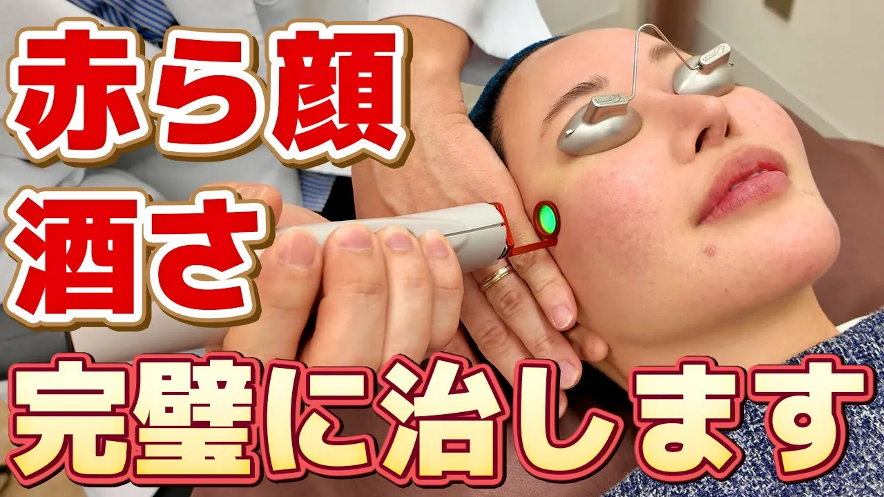 赤ら顔・酒さが酷くて泣いています。