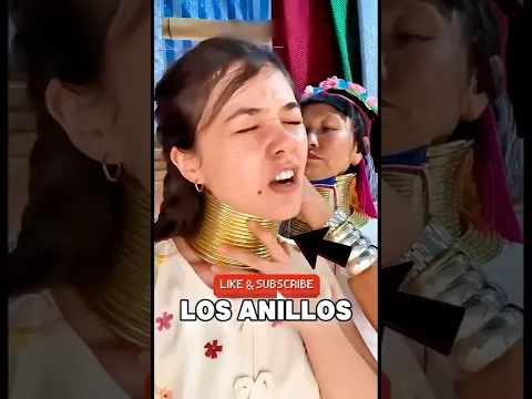 ¿Belleza o peligro La inquietante verdad de los a