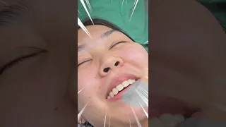 สิวหัวช้างคืออะไร และมีลักษณะอย่างไร