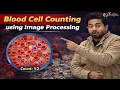 Blood Cell Counting using Image Processing Python Projects for Resume