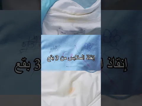 3 حيل لإنقاذ الملابس من البقع… أيّها حدثت معك؟#shorts #tips #miwuscience