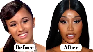 Cardi B s Plastic Surgery Transformation Before After