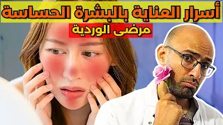 اسرار العناية بالبشرة الحساسة او الملتهبة  هام لمرضى الوردية بالوجه  دندنها