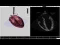 HeartWorks Doppler Features