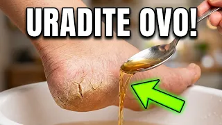 Samo sipajte jabukovo sirće na stopala i sačekajte! Pripremite se za iznenađenje!