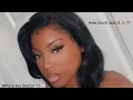 MY SURGERY Q A EXPERIENCE 305 PLASTIC SURGERY DR WILLIAM