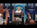 Download Lagu WATCH: Trump has chronic venous insufficiency, remains 'in excellent health,' Leavitt says