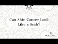 Can skin cancer look like a scab