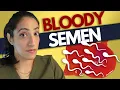 Should you worry about blood in your semen Hematospermia