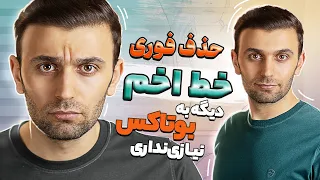 رفع خط اخم با روشی بهتر از بوتاکس Get Rid Of Frown Lines Without Botox 