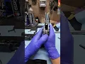 Springfield prodigy common issues