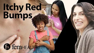 Dermatologist breaks down 7 causes of red itchy bumps What your rash might be