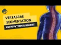 Download Lagu Vertabrae Segmentation using Python and nnUNetv2