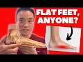 How To Fix Flat Feet With
