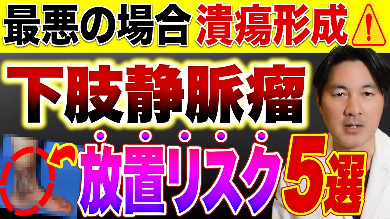 下肢静脈瘤を放置するとどうなる?下肢静脈瘤が悪化する前に知っておきたいこと