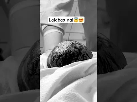 Lalabas na!😍😇 #baby #birthvlog #positivebirth