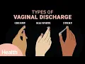 Download Lagu What Vaginal Discharge Says About Your Health | Deep Dives | Health