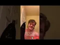 Top Best Pimple Popping TikTok s Compilation