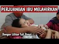 Download Lagu PROSES MELAHIRKAN NORMAL ANAK PERTAMA - DENGAN LILITAN TALI PUSAT