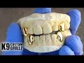 Custom Grillz Set K9 Single Cap Grillz 2 2 Gold Teeth With Hidden Back Bar Bridge