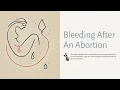 Bleeding After An Abortion Clarewell Clinics