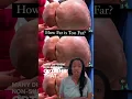 Download Lagu How far are you willing to go to look “better”? #Botched #PlasticSurgeryGoneWrong #BBLTruth