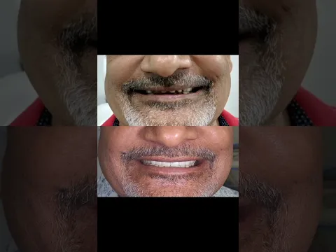 Smile design video testimonial