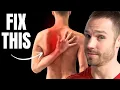 Fix Scapular Winging FAST 3 Simple Steps