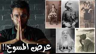 عرض المسوخ في السيرك قديما و الفيلم الممنوع من العرض   تاريخ مؤلم دندنها