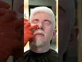 Life-changing makeover for albino man