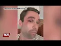 Former Your Hometown Stations meteorologist attacked by New York teens after defending another man