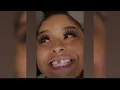 BlueFace Ex - Girlfriend Chrisean Rock Finally Repairs Missing Tooth