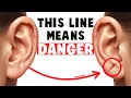 The Line On Your Ear That Predicts Death
