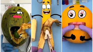 #23 I Tried Food Surgery for 30 Days Here's What Happened
