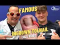Watch Dr. Nick Remove this PAINFUL INGROWN TOENAIL!!!