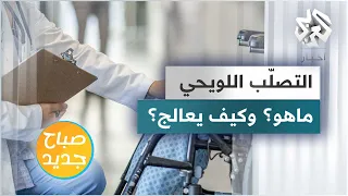 ماهو التصلب المتعدد المعروف ب   التصلب اللويحي   دندنها