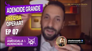 ADENOISE GRANDE PRECISA OPERAR? EP. 07