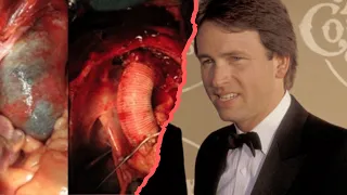John Ritter s Brother Almost Died from the Same Disease as Him