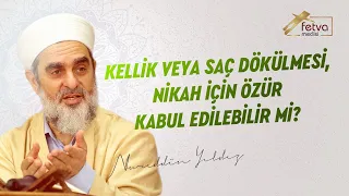 250) Kellik veya Saç Dökülmesi, Nikah İçin Özür Kabul Edilebilir mi?