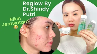 Review Reglow By Dr. Shindy Putri Setelah Pakai 21 Hari (Bikin Jerawatan?)