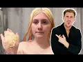 At-Home Bleaching Gone Wrong CRINGE