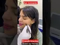 Download Lagu Amazing Dimple Creation Treatment #shorts