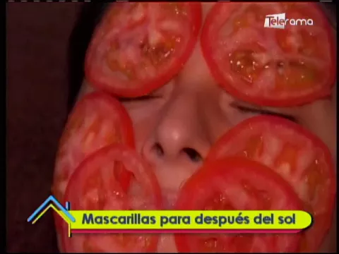 Mascarillas para después del sol