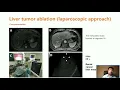 Download Lagu CCMA Webinar Lecture by Dr. Zhe Tang